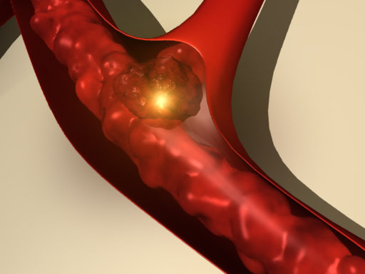 Секреция инсулина клетками поджелудочной железы thumbnail
